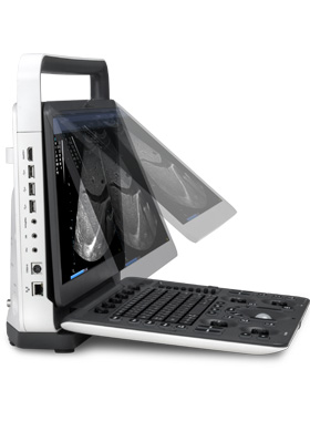 SonoScape E3 Ultrasound