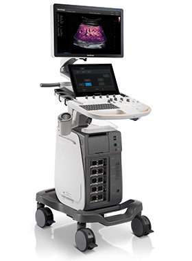 SonoScape P60 High-End Ultrasound with AI