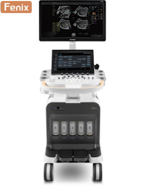 SonoScape P70i Ultrasound