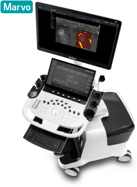 SonoScape S80 Ultrasound