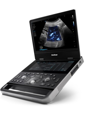 SonoScape X11 Ultrasound