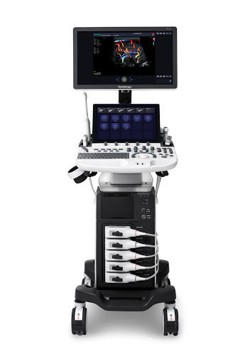 SonoScape P50 Ultrasound